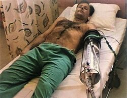 Termonor kjølerør var et bidrag innen medisinsk forskning.